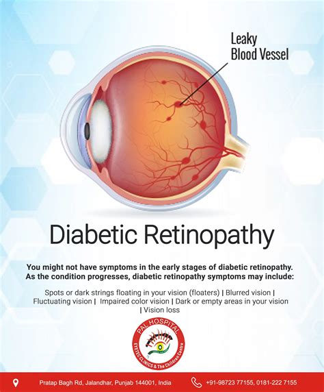 retinopathy test eye drops|drugs to treat diabetic retinopathy.